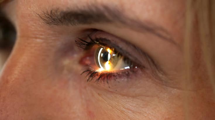 Le Vabysmo de Roche est désormais homologué dans l'UE pour les deux affections rétiniennes qui sont les principales causes de perte de vision dans le monde. (archives)
