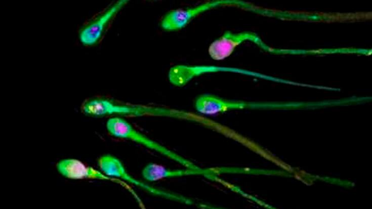 Selon Swissmedic, le vaccin contre le Covid-19 ne réduit pas le nombre de spermatozoïdes. Le virus peut en revanche l'influencer (Archives).