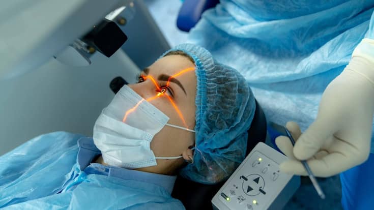 chirurgie réfractive