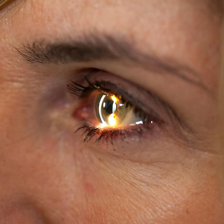 Le Vabysmo de Roche est désormais homologué dans l'UE pour les deux affections rétiniennes qui sont les principales causes de perte de vision dans le monde. (archives)
