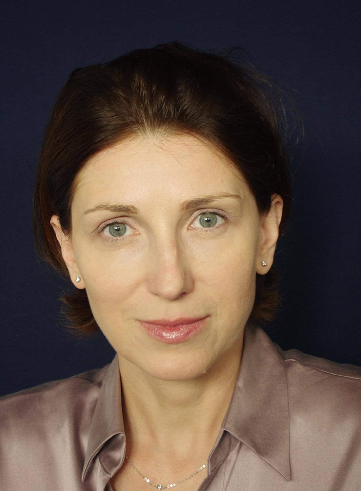 file7a1kaux2euts00treqi